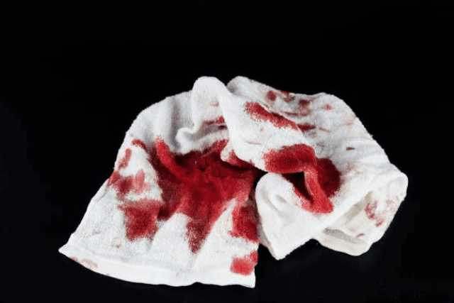 Did You Dream About… Bloody Clothes