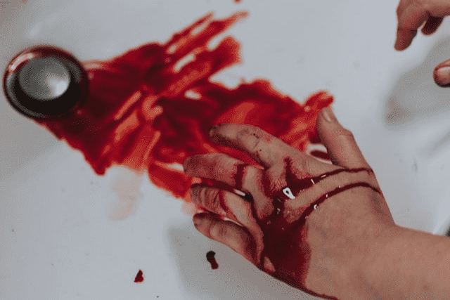 Did You Dream About… Losing Blood